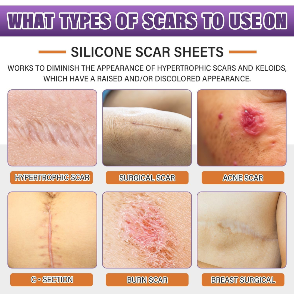 SnapGlam Silicone Scar Sheets
